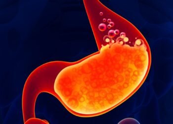 Ilustrasi Asam Lambung (klikdokter)