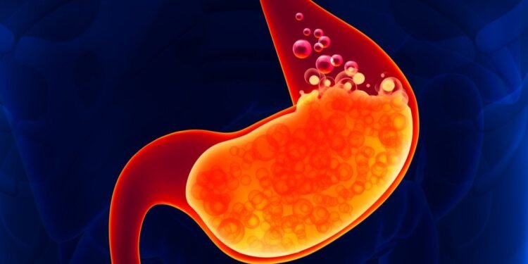 Ilustrasi Asam Lambung (klikdokter)