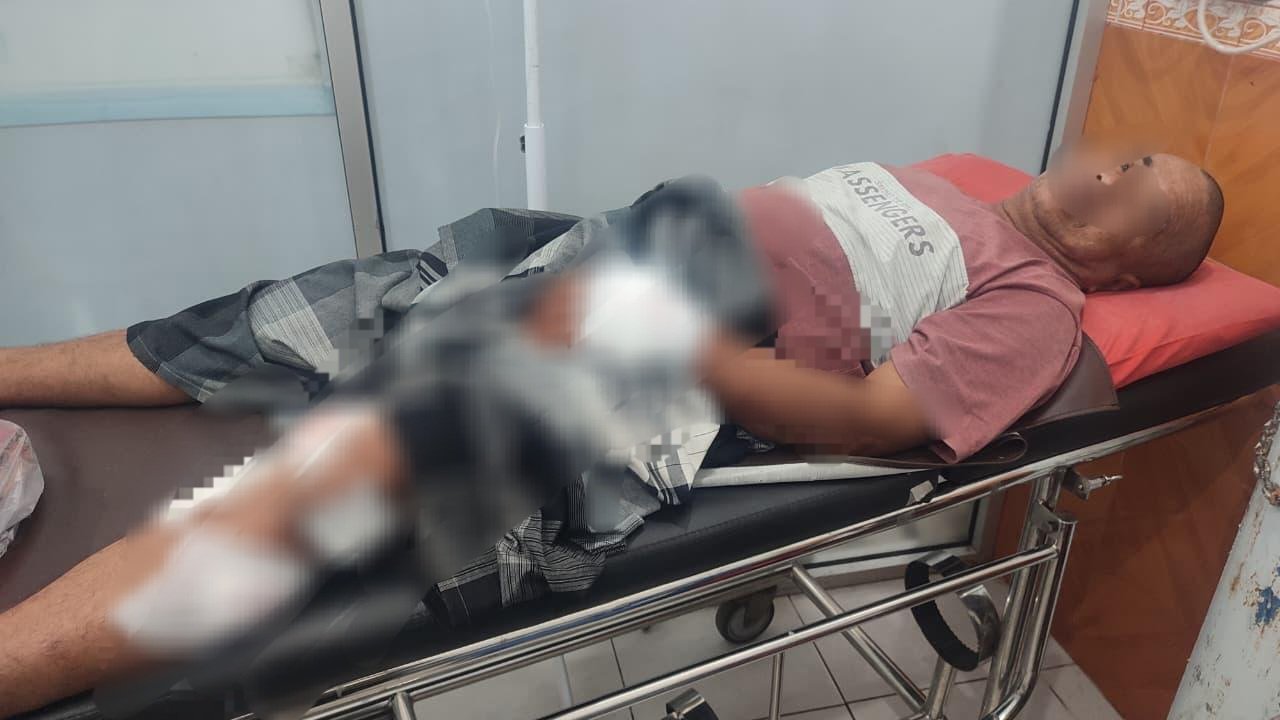 Kondisi warga yang diserang buaya