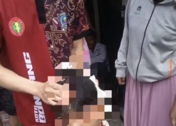 Kondisi salah satu pelajar di Bontang akibat kecelakaan dan kepalanya dipenuhi darah