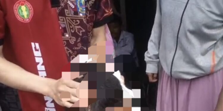 Kondisi salah satu pelajar di Bontang akibat kecelakaan dan kepalanya dipenuhi darah
